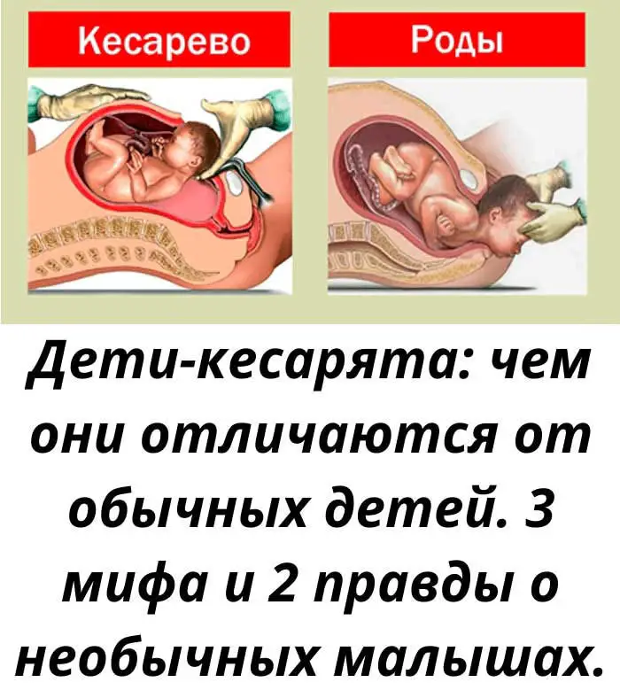 Кесарята и дети, рождённые естественным путём: мифы, правда и скрытые нюансы рождения